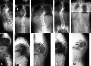 129v57n03-90204818fig1