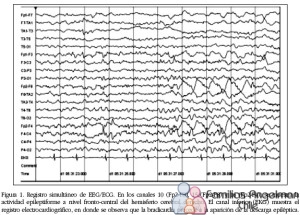 fig12-01